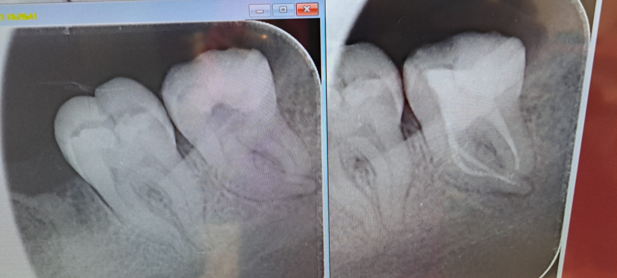 Clinical case 2